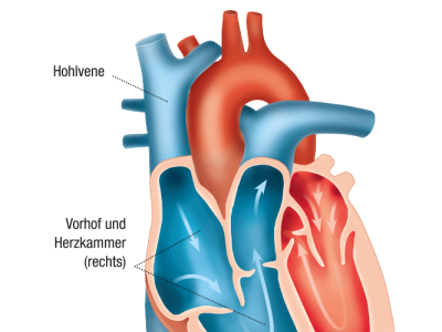 TheraKey® Schaukarten